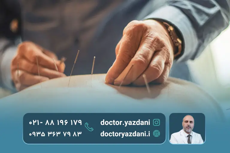 طب سوزنی چیست